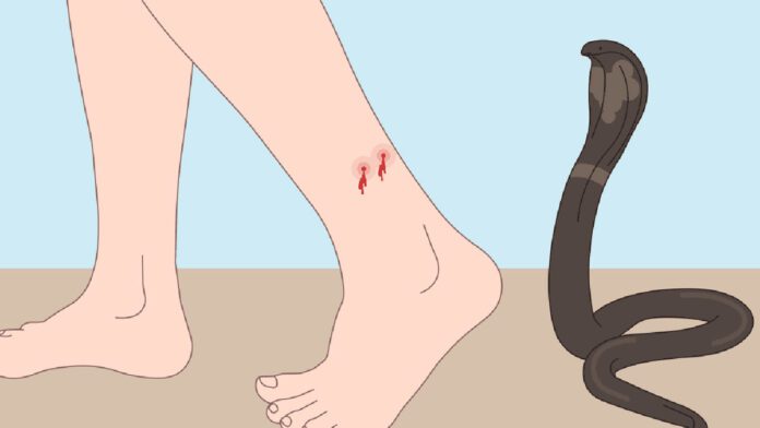 Snake Bite Treatment in Tamil